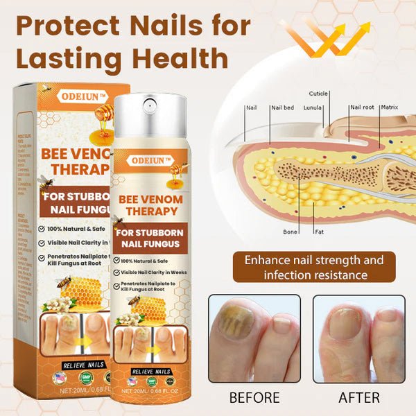 Bee Venom Nail Fungus Spray