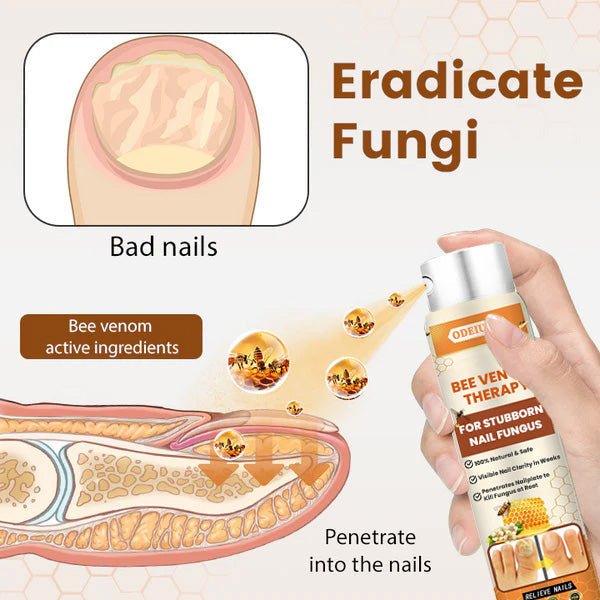 Bee Venom Nail Fungus Spray
