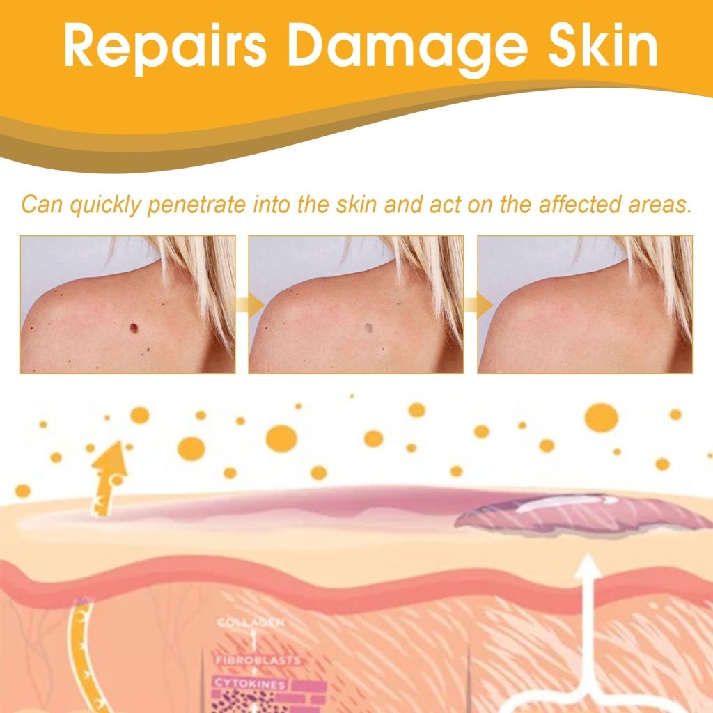 XIMONTH Bee Venom Care Spray