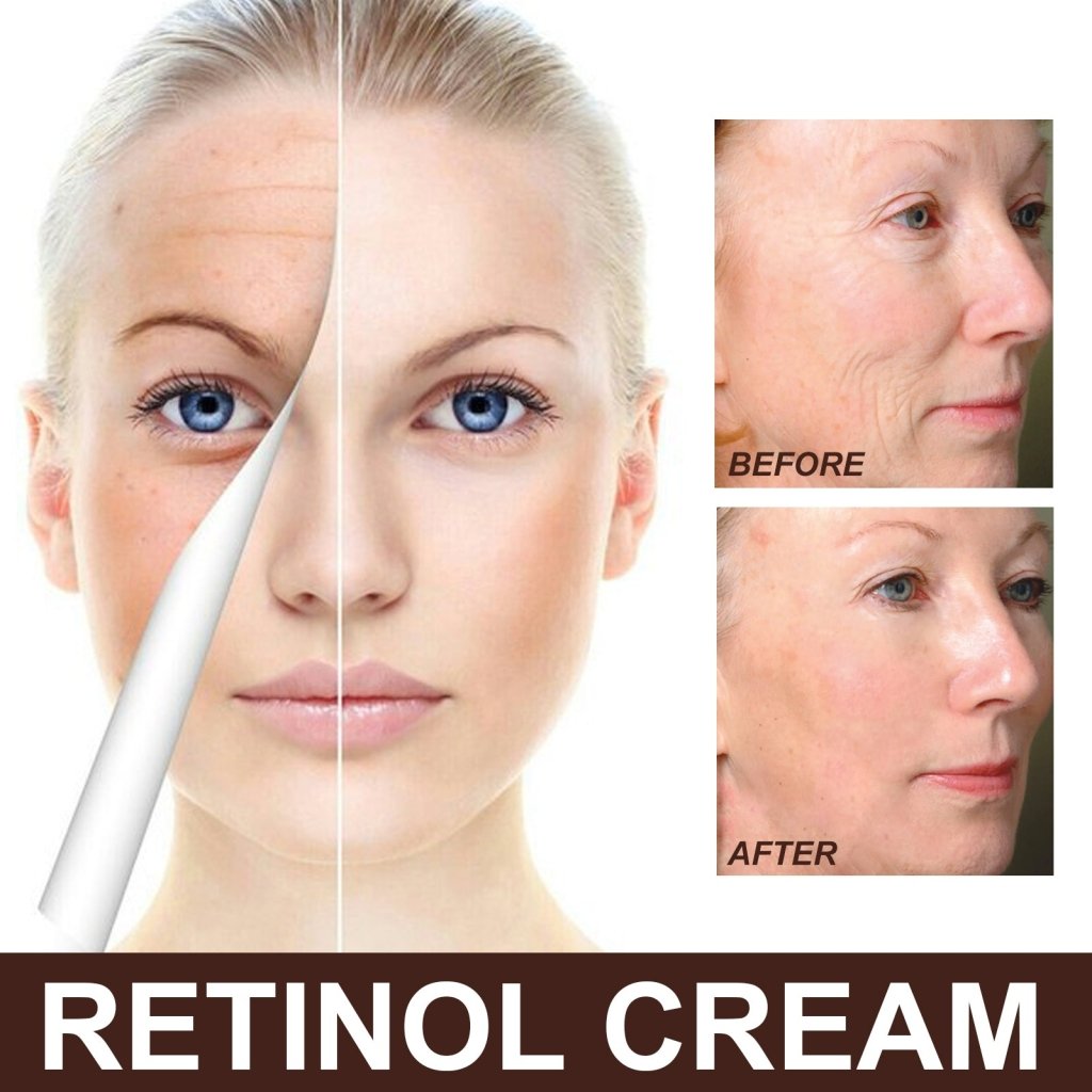 EELHOE Retinol Cream – Youthful, Radiant Skin Made Simple