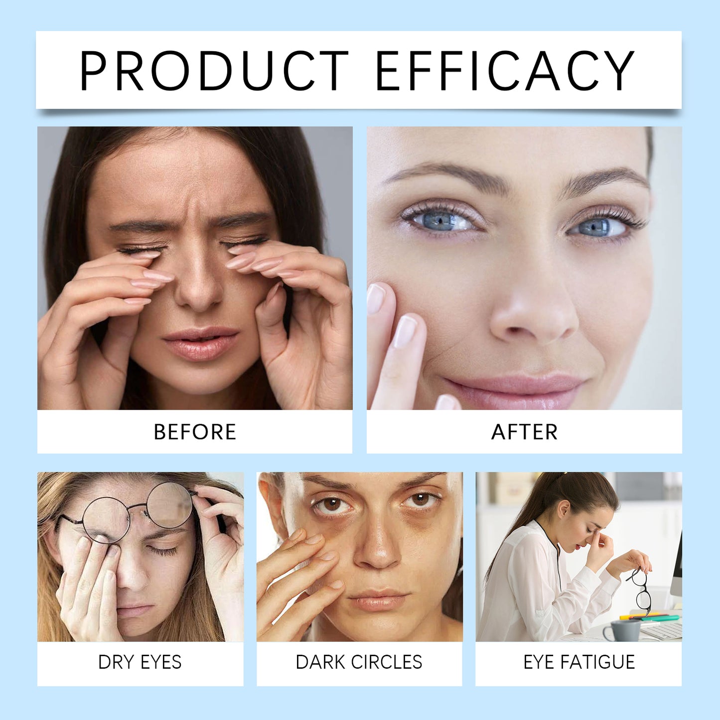 XIMONTH Rollerball Eye Essence – Revitalize Tired Eyes & Reduce Dark Circles